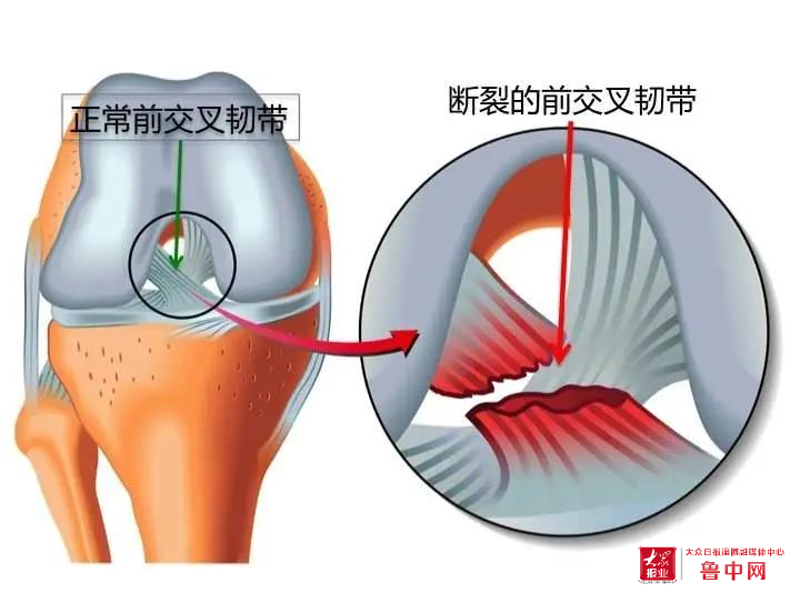 深圳运动康复：在繁忙城市的绿肺中恢复活力